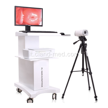Colposcopio video digitale medico portatile per ginecologia